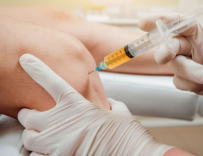 What Is the Cost of Platelet-Rich Plasma